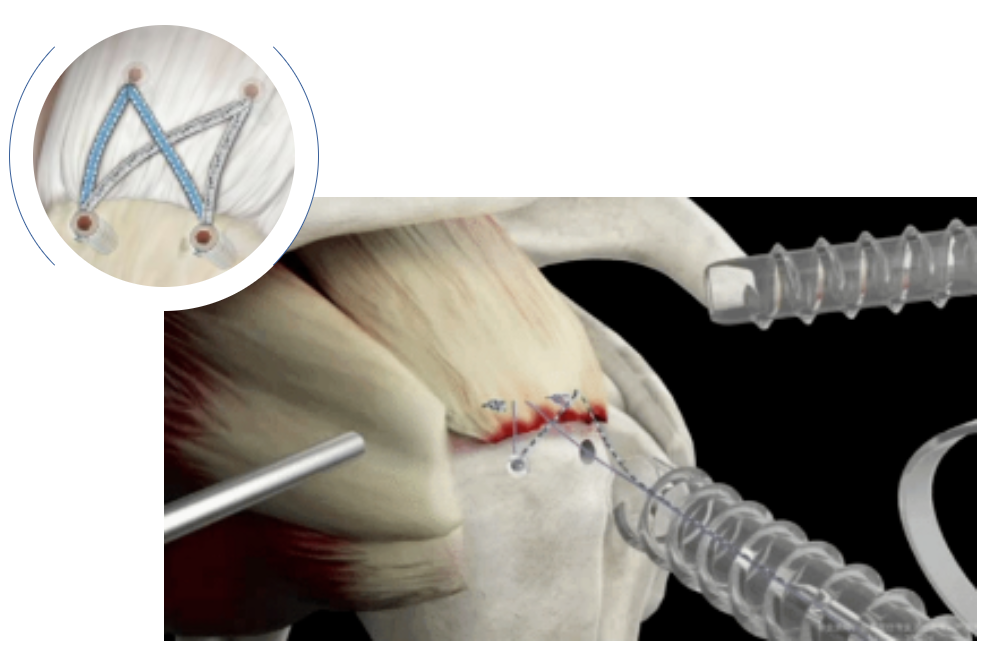 微信圖片_20241122125640 微信圖片_20241122125640