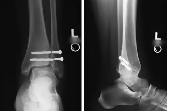 WPS圖片(1) WPS圖片(1)